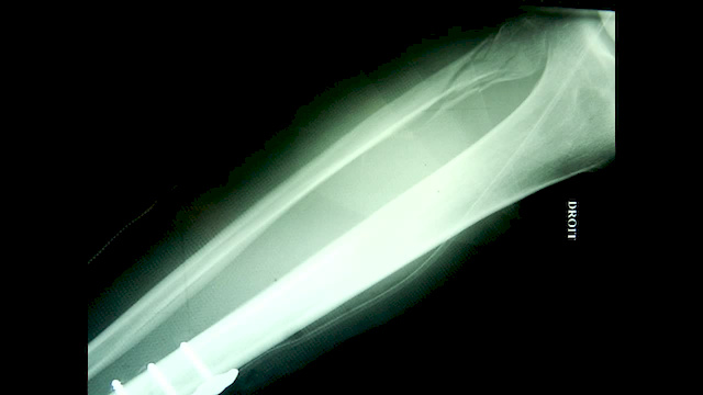 Must Watch Video